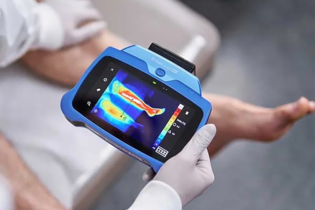 Breakthrough in Wound Care: MolecuLightDX Earns FDA MDDT Status