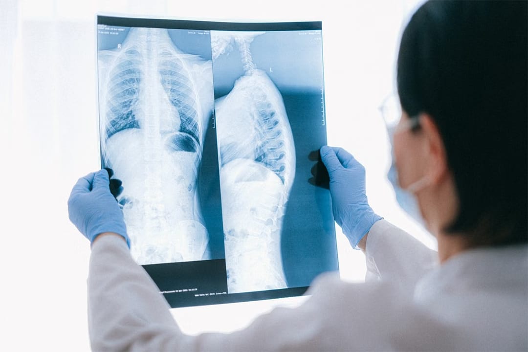 GRI Bio Won Orphan Drug Status the Same Day MAIA Opened a Third Cancer Trial Site